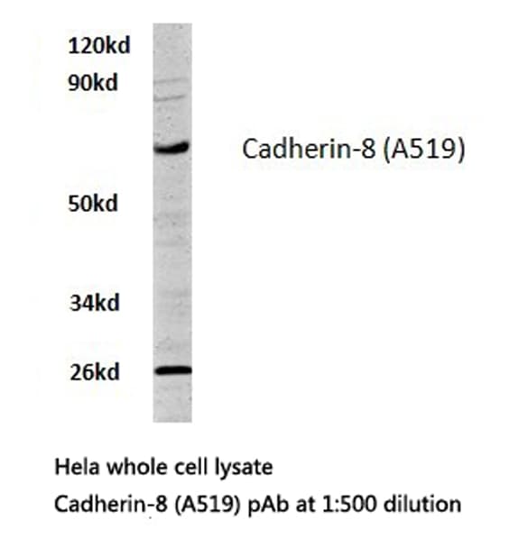 CDH8 / Cadherin 8 Antibody (Ala519)