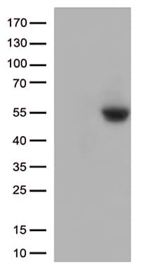 CD274 / B7-H1 / PD-L1 Antibody (clone OTI9E5, Carrier-free)