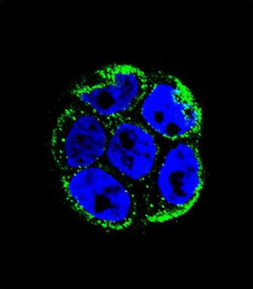 Villin-Like / VILL Antibody (aa385-412)