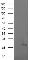 CTAG1B / NY-ESO-1 Antibody (clone OTI4G7)