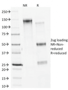 CANX / Calnexin Antibody (clone CANX/1541)