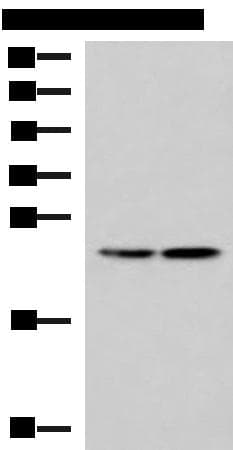 RGS2 Antibody