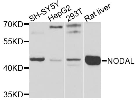 Polyclonal Rabbit anti-Human NODAL Antibody (WB)