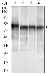 PathPlus™ KRT5 / CK5 / Cytokeratin 5 Antibody (aa316-590, clone 2C2B4)