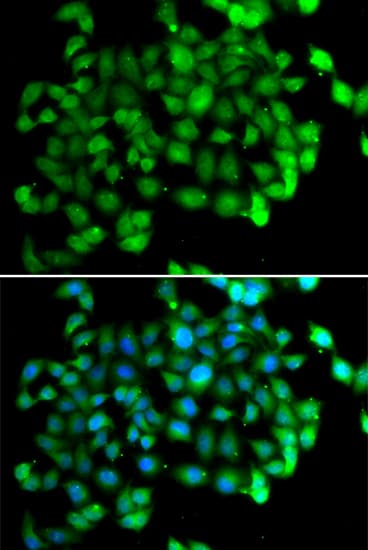APOBEC3C Antibody