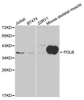 POLB / DNA Polymerase Beta Antibody