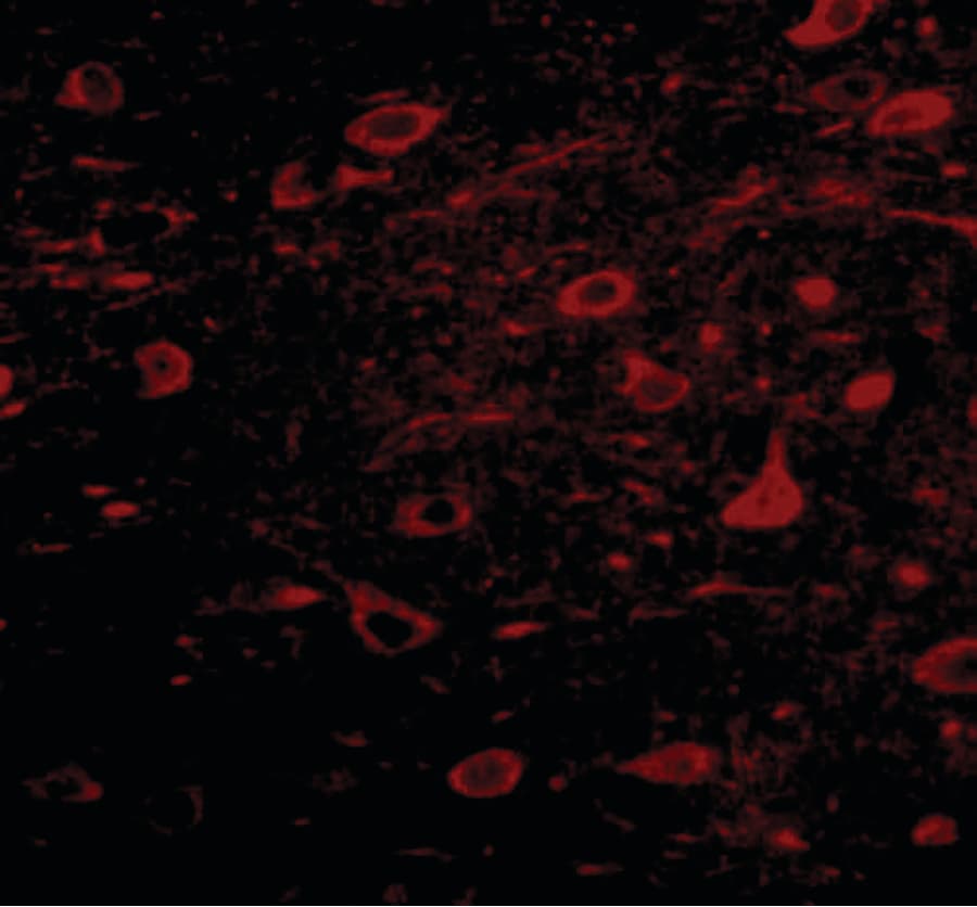 Polyclonal Rabbit anti-Human ZNF667 / MIPU1 Antibody (IHC, IF, WB)
