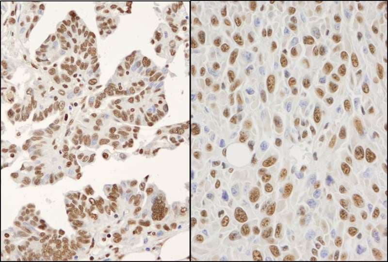 Polyclonal Rabbit anti-Human HNRNPK / hnRNP K Antibody (aa1-50, IHC, WB)