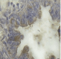 Monoclonal Mouse CA125 Antibody (clone 325, WB)