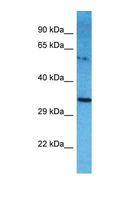 Polyclonal Rabbit anti-Human NME9 / TXNDC6 Antibody (aa121-170, WB)