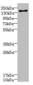 Polyclonal Rabbit anti-Human SCN7A Antibody (IHC, WB)