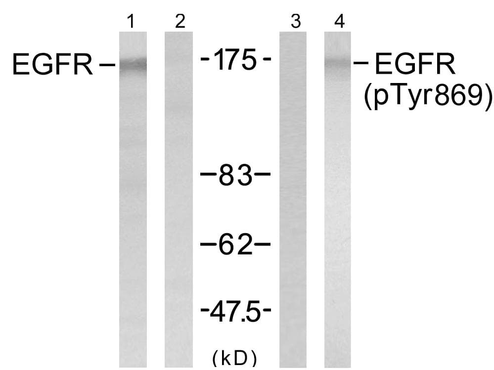 Polyclonal Rabbit anti-Human EGFR Antibody (phospho-Tyr869, WB)
