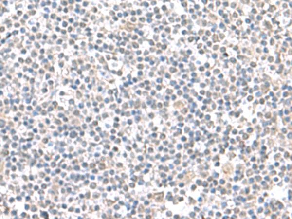 IFI27 / p27 Antibody