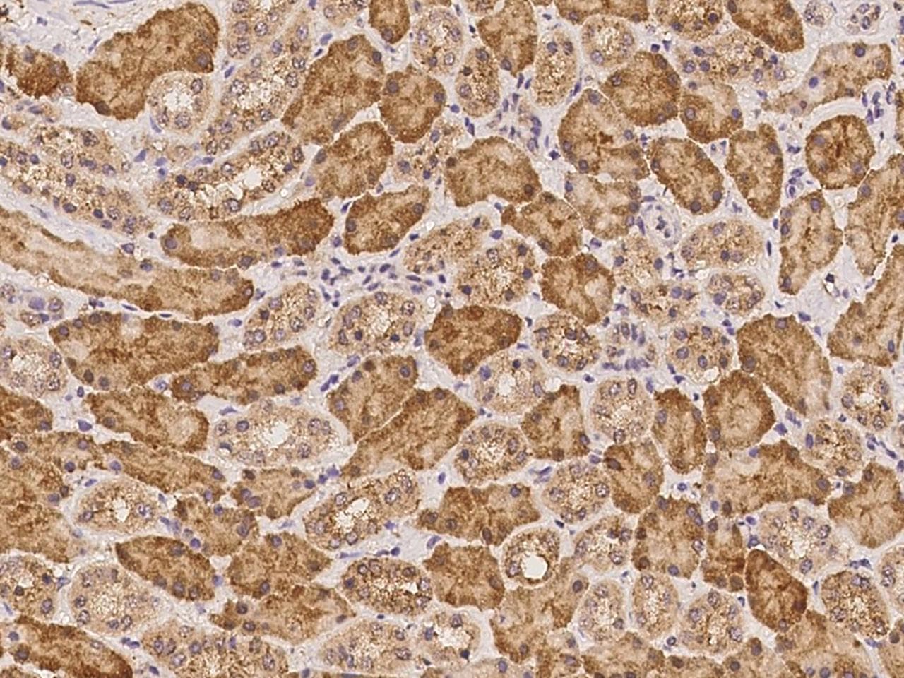 LRRC74A Antibody