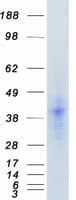 Human FGF2 / Basic FGF Protein (Recombinant Myc-DDK (Flag))