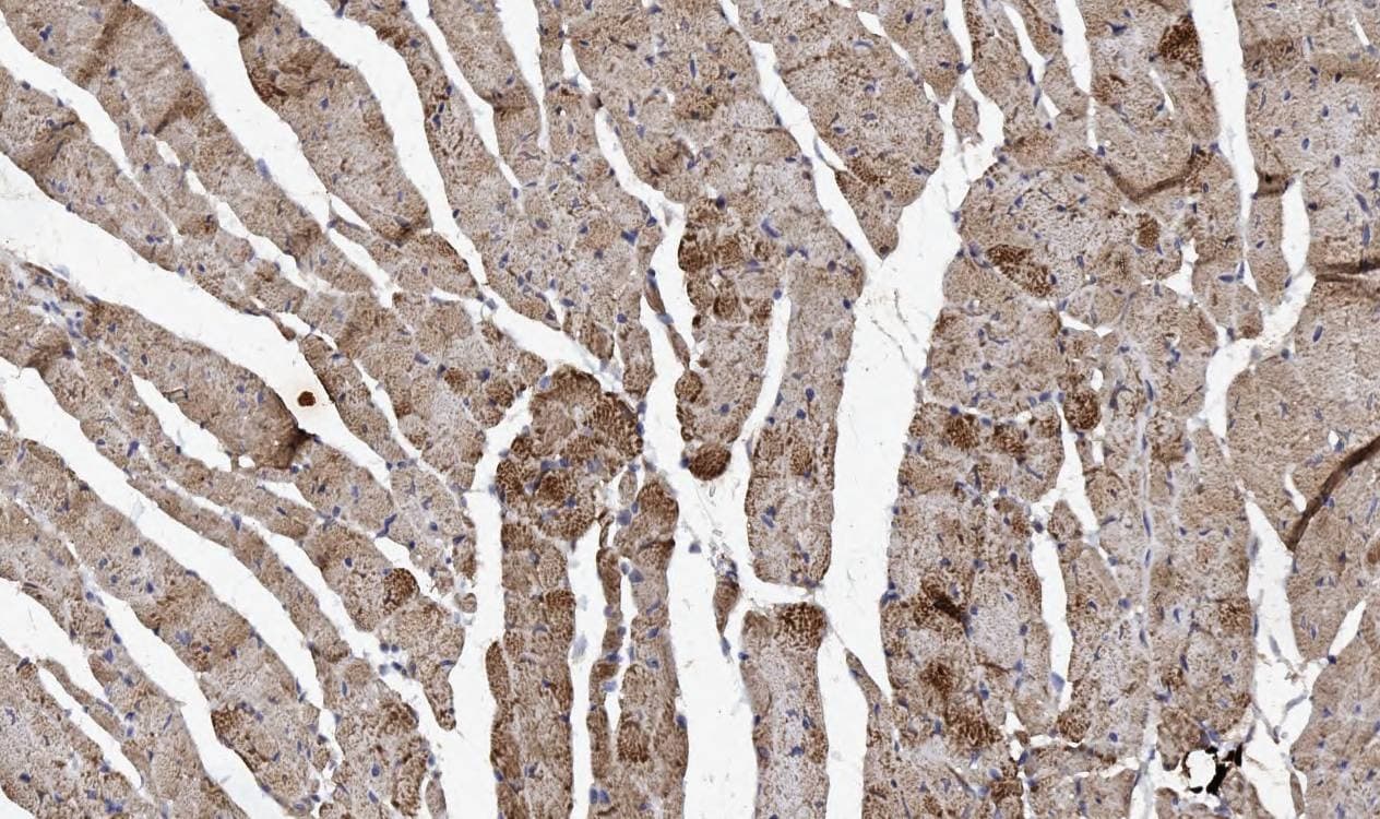 Polyclonal Rabbit anti-Human NDUFA1 Antibody (aa54-70, IHC, WB)