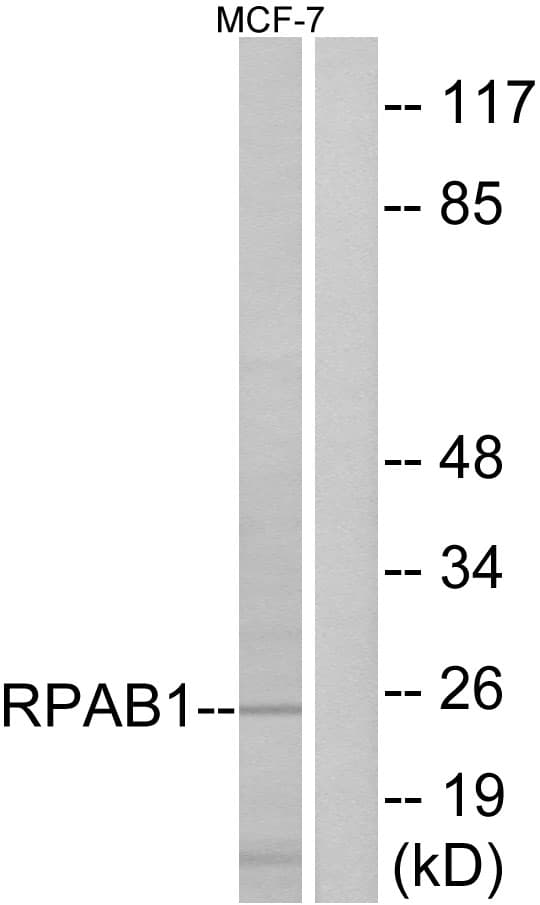 POLR2E Antibody (aa21-70)