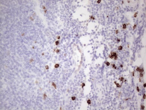 Monoclonal Mouse anti-Human c-Kit / CD117 Antibody (clone OTI2B12, aa27-308, IHC, WB)