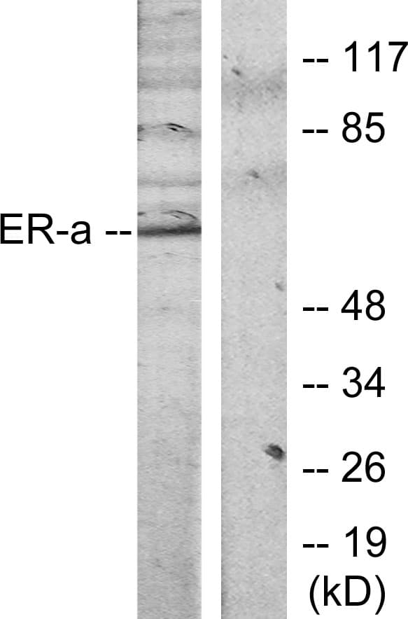 IHC-plus™ ER Alpha / Estrogen Receptor Antibody (aa91-140)