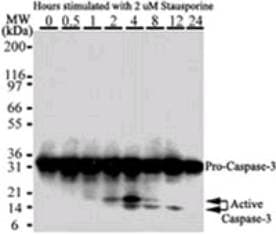 IHC-plus™ CASP3 / Caspase 3 Antibody (clone 31A1067)