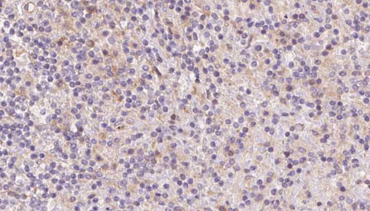 TMOD4 Antibody