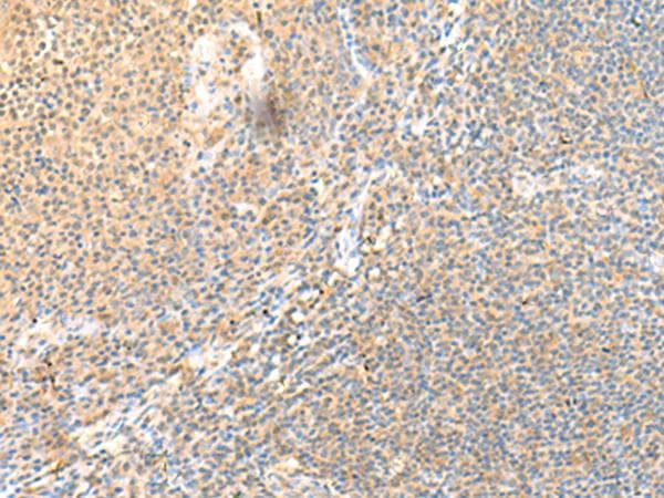 Polyclonal Rabbit anti-Human SSC4D / SRCRB4D Antibody (IHC)