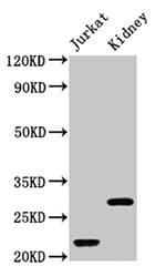 HIST1H1C Antibody