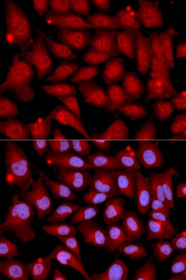 Polyclonal Rabbit anti-Human MAP2K6 / MEK6 / MKK6 Antibody (IHC, IF, WB)