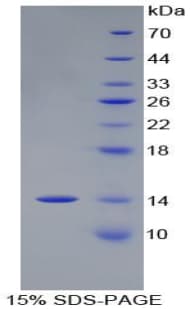 Chicken Procalcitonin Protein (Recombinant His)