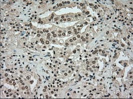 Monoclonal Mouse anti-Human BUB1B / BubR1 Antibody (clone OTI10B7, IHC, IF, WB)