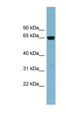 Polyclonal Rabbit anti-Human IL22RA1 / IL22R Antibody (aa251-300, WB)