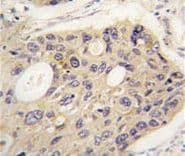 APG12 / ATG12 Antibody