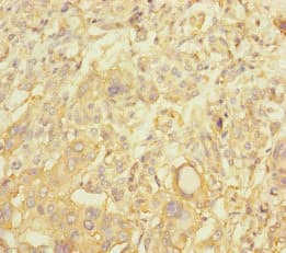 NBAS / NAG Antibody