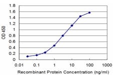 MDH / MDH2 Antibody (clone 2D9)