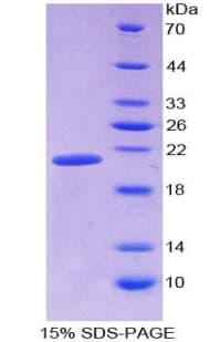 Human AIF1 / IBA1 Protein (Recombinant)