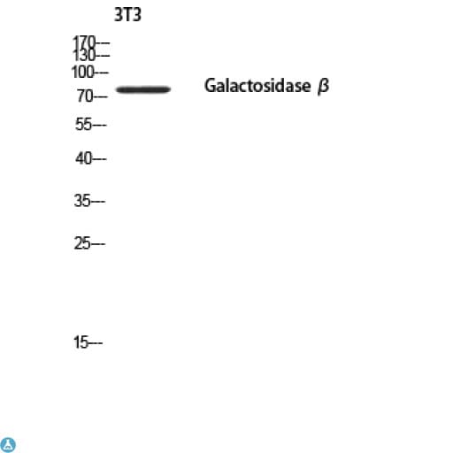 Polyclonal Rabbit anti-Human GLB1 / Beta-Galactosidase Antibody (IHC, WB)