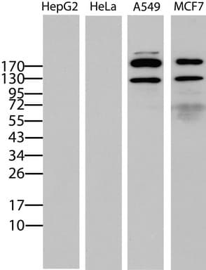 ERBB2 / HER2 Antibody (aa676-1255, clone UMAB35)