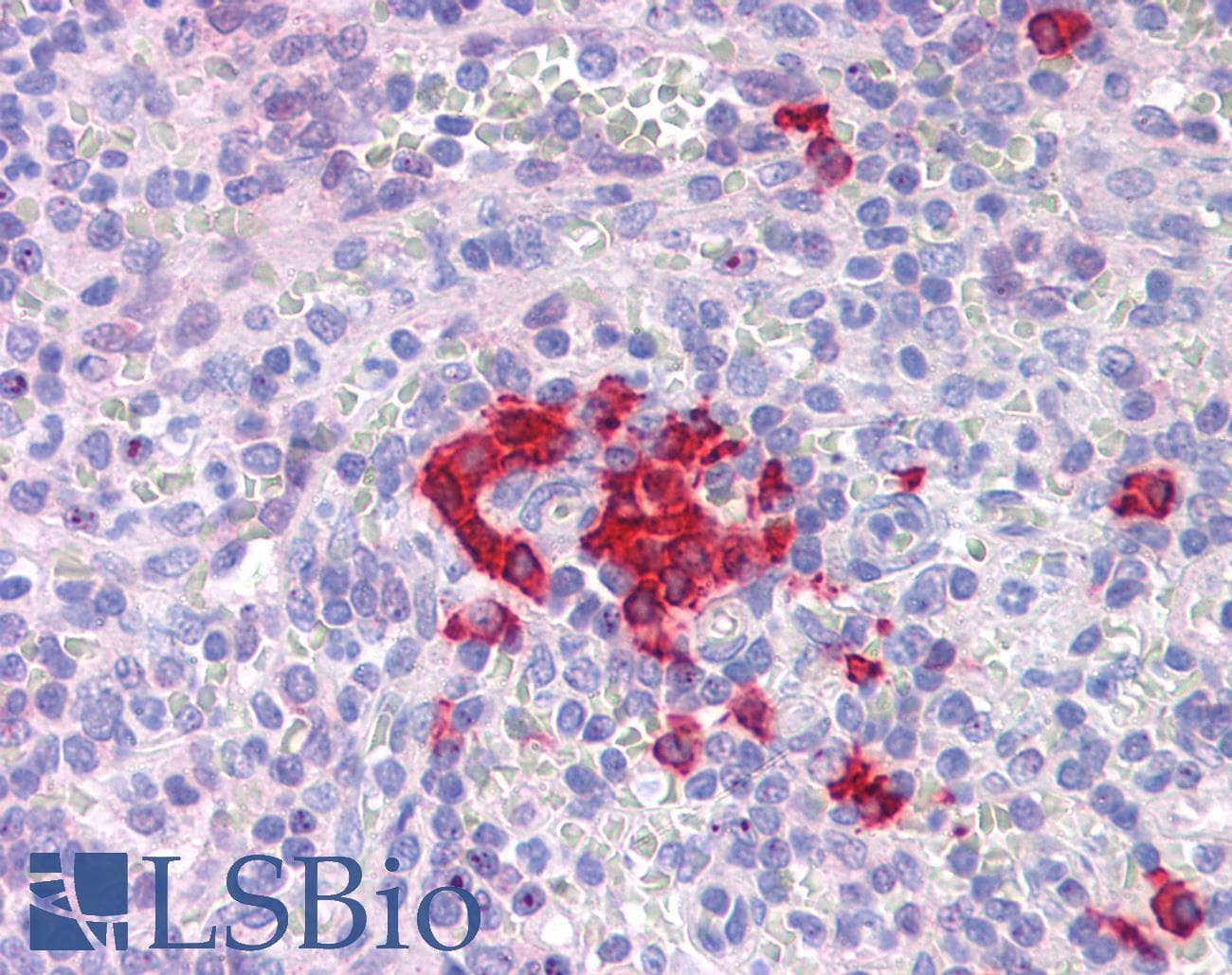 IHC-plus™ FOXO4 / AFX1 Antibody