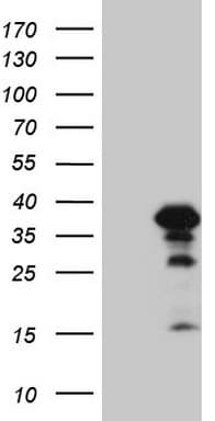 ZC3H8 Antibody (clone OTI13F2, Carrier-free)