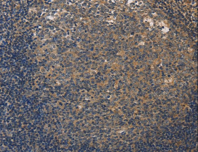 Polyclonal Rabbit anti-Human DUSP26 / MKP8 Antibody (IHC)
