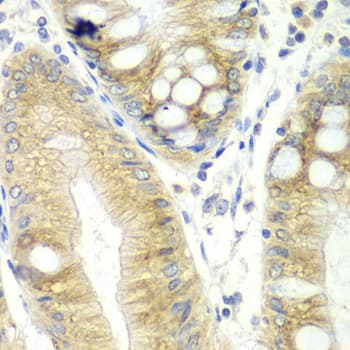 CES2 / Esterase Antibody