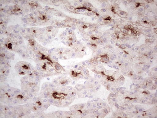 ABCB1 / MDR1 / P Glycoprotein Antibody (aa995-1280, clone OTI8A9)