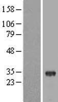 THAP8 Protein (Over-Expression Lysate Myc-DDK (Flag))