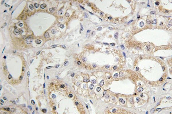 GRB14 Antibody (Asp123)