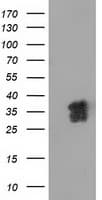 Monoclonal Mouse anti-Human NHEJ1 / XLF Antibody (clone OTI1G5, IF, WB)