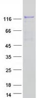 Human ABL2 Protein (Recombinant Myc-DDK (Flag))
