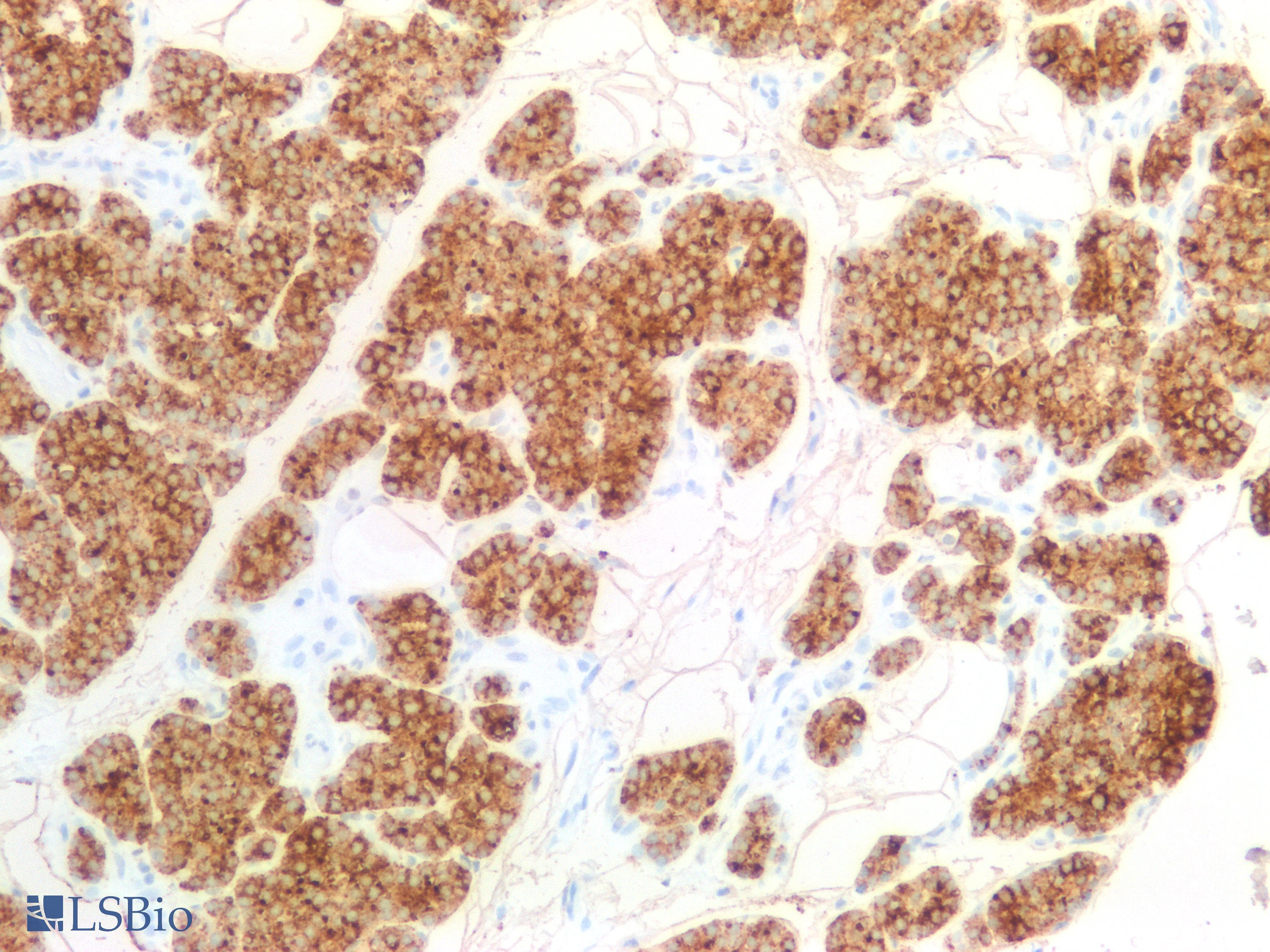 PathPlus™ PTH / Parathyroid Hormone Antibody (clone PTH/2295R)