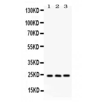 BAG2 Antibody (aa1-211)