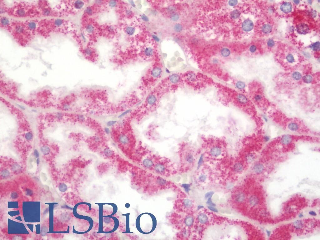 IHC-plus™ SHREW-1 / AJAP1 Antibody