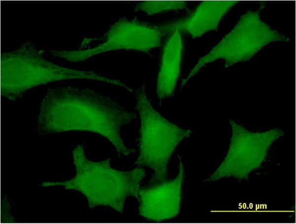 LDHC / Lactate Dehydrogenase C Antibody (clone 2C8)